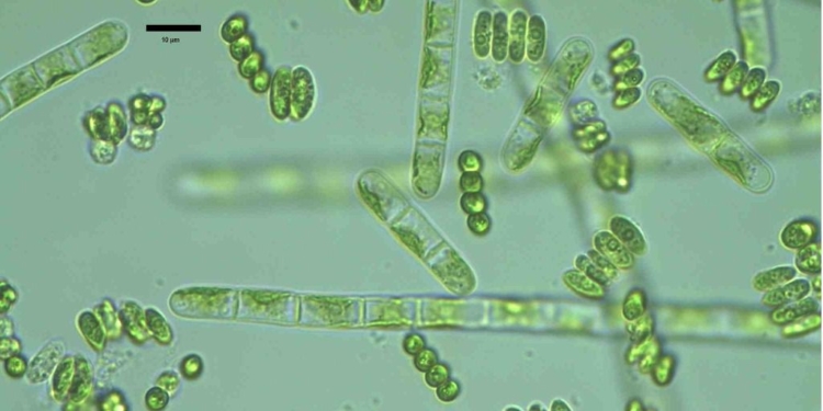 Las microalgas se cultivan en laboratorios / Fotos: Ongen