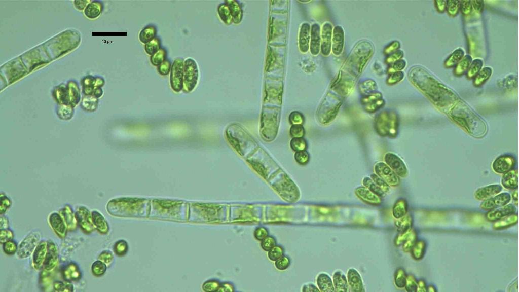 Las microalgas se cultivan en laboratorios / Fotos: Ongen