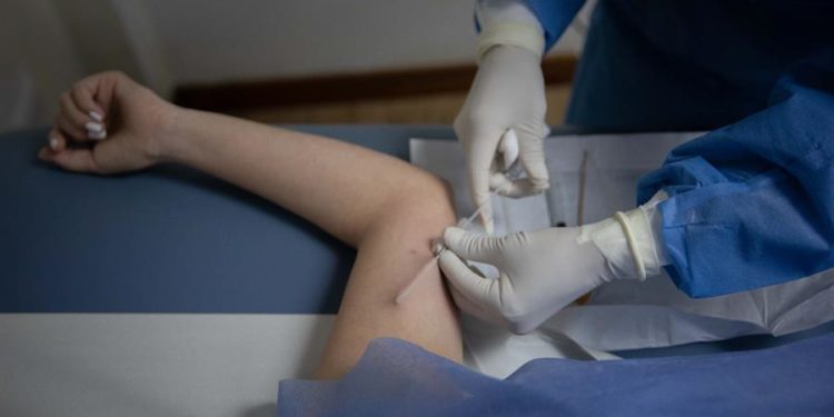 La doctora Fabiola Galvis le coloca un implante anticonceptivo a una paciente, el 13 de septiembre de 2021 en la clínica de Plafam en Caracas Venezuela / Rayner Peña / EFE.