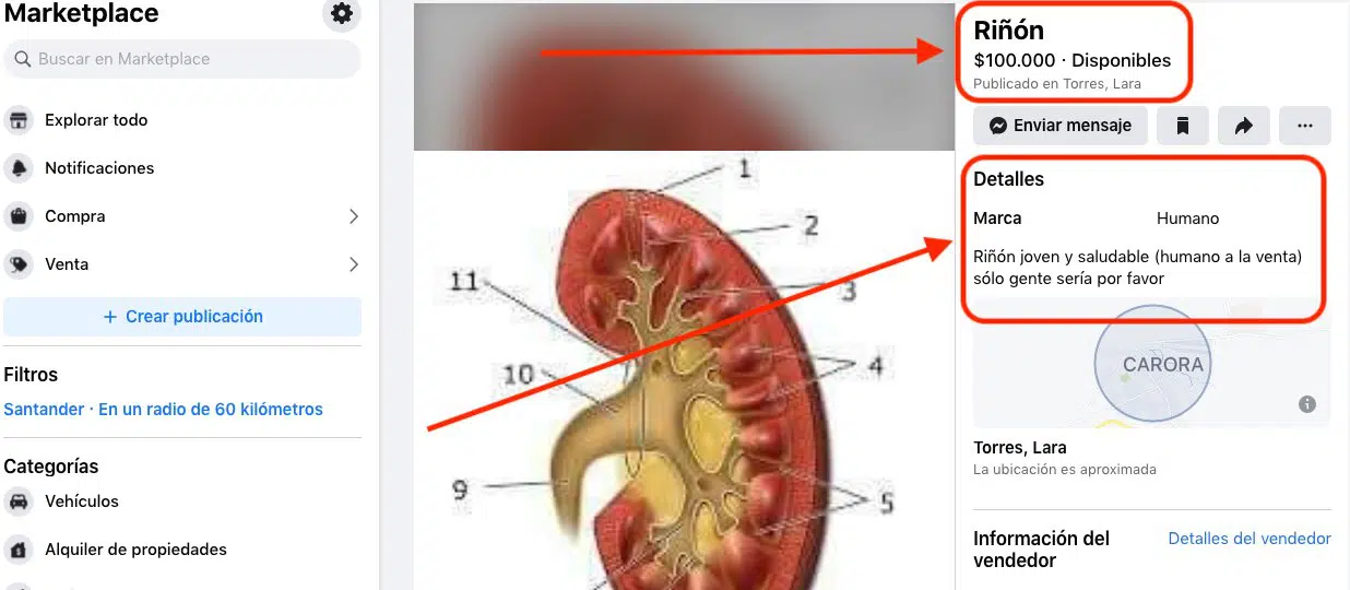 "Se vende riñón en perfecto estado": La insólita publicación que arroja luces sobre la crisis de Venezuela (+fotos)