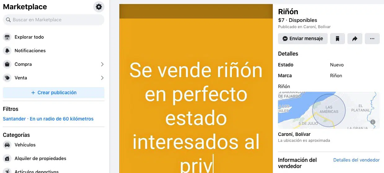 "Se vende riñón en perfecto estado": La insólita publicación que arroja luces sobre la crisis de Venezuela (+fotos)